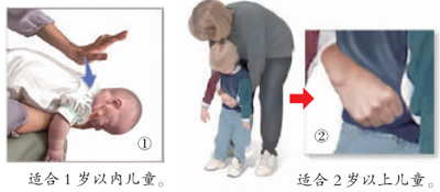 威海58岁助孕男孩-如果你的孩子吞下了异物，该怎么办？(图1)