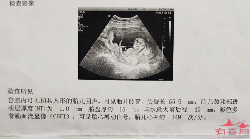 常州助孕男孩官网：12周能看出宝宝的性别吗？(图1)